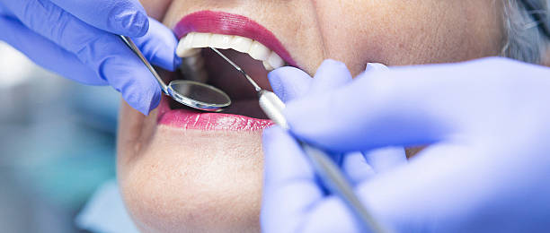 Best Broken or Cracked Tooth Emergency Dentist in Hopelawn, NJ